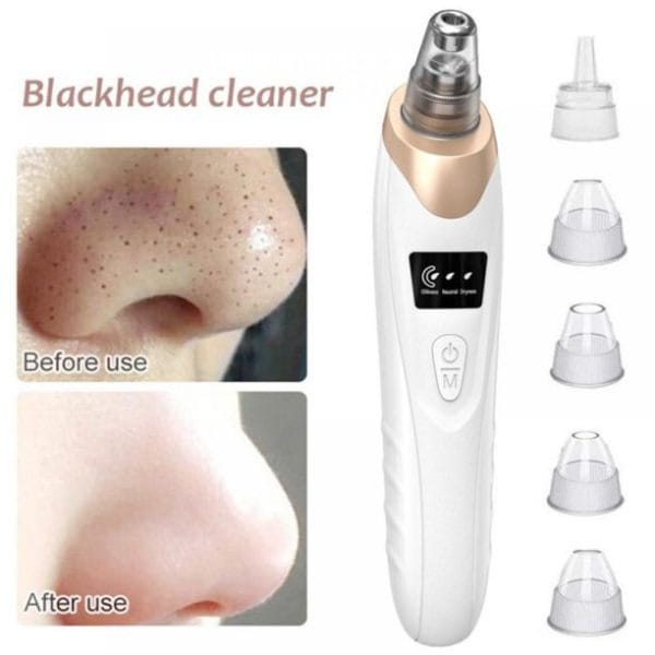 Electric Blackhead Remover Vacuum – Deep Pore Cleansing Facial Cleaner | Premium Quality